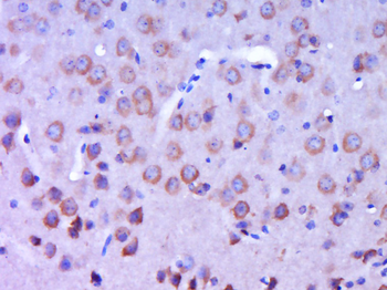 CSPS/MPST Rabbit Polyclonal Antibody
