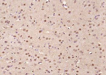 Phospho-CTBP1 (Ser422) Rabbit Polyclonal Antibody