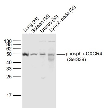CXCR4 (Phospho-Ser339) antibody