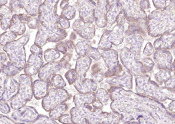 ACKR3 Rabbit Polyclonal Antibody