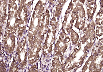 Cytohesin 2 Rabbit Polyclonal Antibody