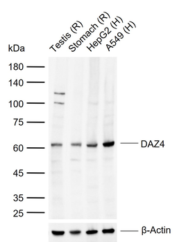 DAZ4 Rabbit Polyclonal Antibody