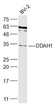 DDAH1 Rabbit Polyclonal Antibody