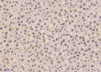 DHX32 Rabbit Polyclonal Antibody