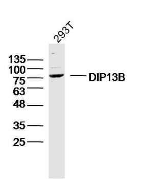 DIP13B Rabbit Polyclonal Antibody