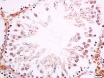 Dmrta1 Rabbit Polyclonal Antibody