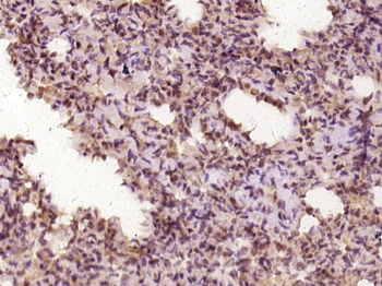 DNA polymerase delta Rabbit Polyclonal Antibody