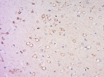DNA Polymerase iota Rabbit Polyclonal Antibody
