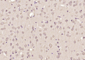 DNAJC9 Rabbit Polyclonal Antibody