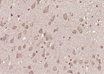 DOCK7 Rabbit Polyclonal Antibody