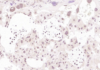 DUSP5 Rabbit Polyclonal Antibody