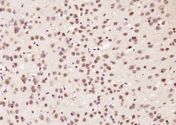 DYX1C1 Rabbit Polyclonal Antibody