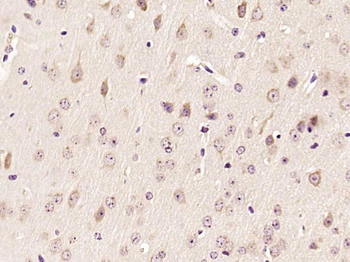 ECH1 Rabbit Polyclonal Antibody