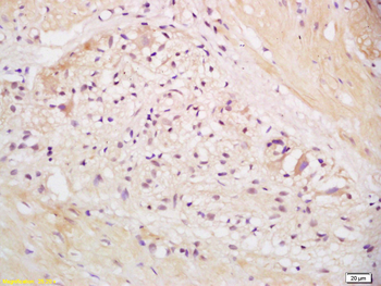 EEA1 Rabbit Polyclonal Antibody