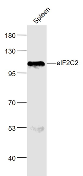 AGO2 Rabbit Polyclonal Antibody
