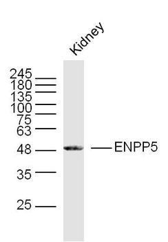 ENPP5 Rabbit Polyclonal Antibody
