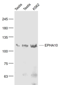 EPHA10 Rabbit Polyclonal Antibody