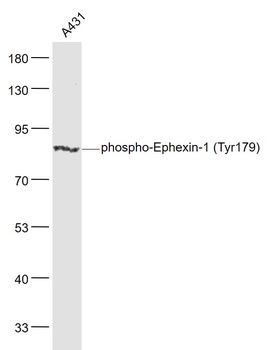 Ephexin-1 (Phospho-Tyr179) antibody