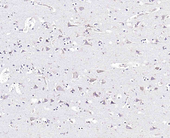 Epsin 1 Rabbit Polyclonal Antibody