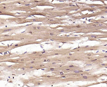 Phospho-ERK5 (Thr218 + Tyr220) Rabbit Polyclonal Antibody