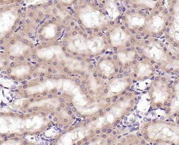 Phospho-ERK5 (Thr218 + Tyr220) Rabbit Polyclonal Antibody