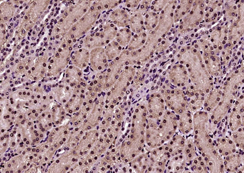 ESRP2 Rabbit Polyclonal Antibody