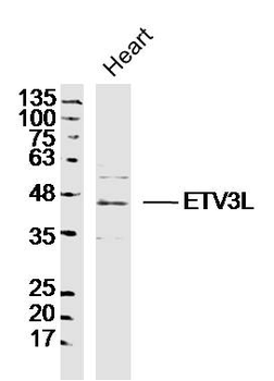 ETV3L Rabbit Polyclonal Antibody