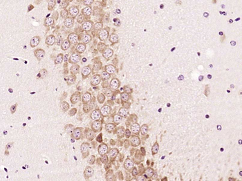 EXOC2 Rabbit Polyclonal Antibody