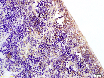 ZNF521 Rabbit Polyclonal Antibody
