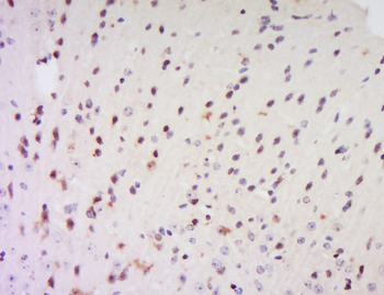 EXOSC7 Rabbit Polyclonal Antibody