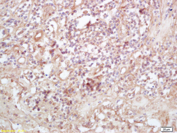 Exportin 1 Rabbit Polyclonal Antibody