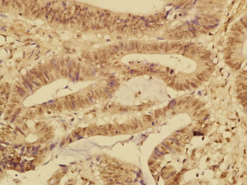 FABP12 Rabbit Polyclonal Antibody