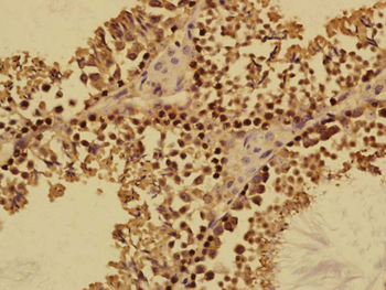FABP12 Rabbit Polyclonal Antibody