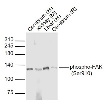 FAK(Phospho-Ser910) antibody