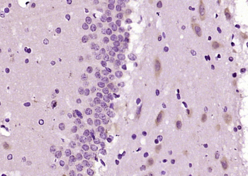 FAM62C Rabbit Polyclonal Antibody