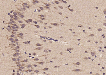 FEZ2 Rabbit Polyclonal Antibody