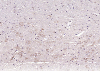 Fibrillin 2 Rabbit Polyclonal Antibody