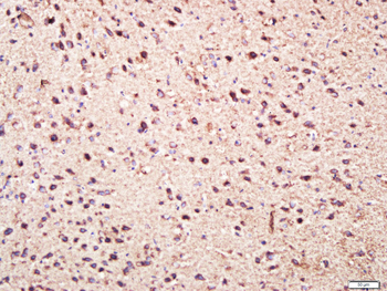 FKBP10 Rabbit Polyclonal Antibody