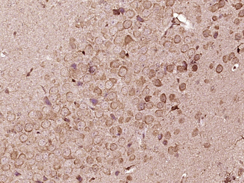 FKBP51 Rabbit Polyclonal Antibody