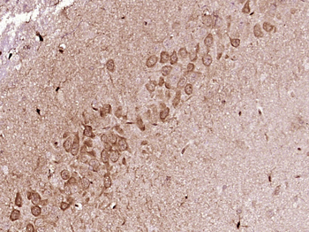 FKBP51 Rabbit Polyclonal Antibody