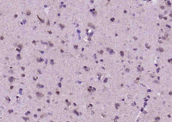 OLIG1 Rabbit Polyclonal Antibody