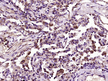 FLVCR Rabbit Polyclonal Antibody