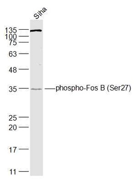 Phospho-Fos B (Ser27) Rabbit Polyclonal Antibody