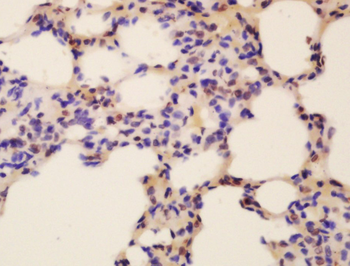 RBFOX2 Rabbit Polyclonal Antibody
