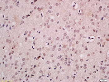 FOXB1 Rabbit Polyclonal Antibody