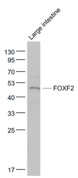 FOXF2 Rabbit Polyclonal Antibody