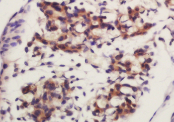 FZD4 Rabbit Polyclonal Antibody