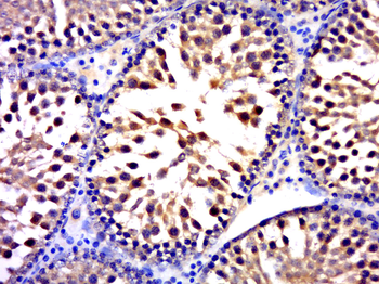 FUSIP1 Rabbit Polyclonal Antibody