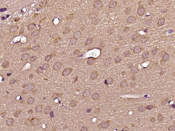 FUT11 Rabbit Polyclonal Antibody