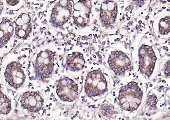 FUT2 Rabbit Polyclonal Antibody